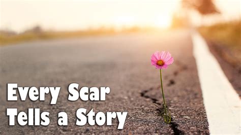 Every Scar Tells A Story In Gods Image