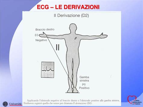 PPT INTERPRETAZIONE DELLELETTROCARDIOGRAMMA PowerPoint Presentation