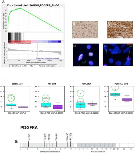 Pdgfra Amplificationmutation Is Driving The Oncogenesis Of The