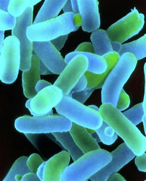 Shigella Dysenteriae Bacteria Photograph By Dr Kari Lounatmaascience Photo Library