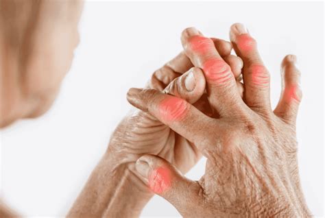 Arthritis And Rheumatology Near Las Vegas Symptoms Causes And