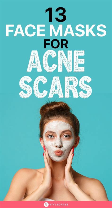 13 Best Face Masks For Acne Scars In 2023 That You Must Try With Reviews Artofit