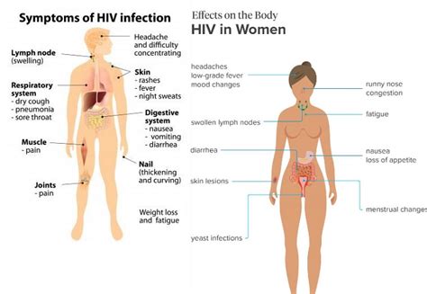 Hiv Aids Symptoms In Women