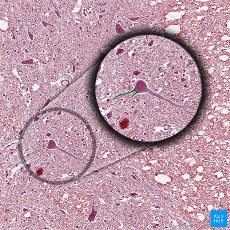 Merkel Discs Histology / Skin - Slide #4 : Here, the myocardial cells ...