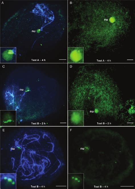 Fluorescence In Situ Hybridization Mapping Of The RDNA 45S Sequence