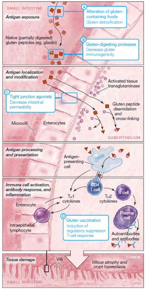 Pathophysiology Of Celiac Disease And Potential Nondietary Therapies Download Scientific