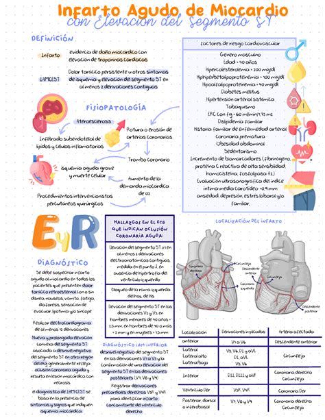 Infarto Agudo De Miocardio Con Elevaci N Del Segmento St Evidencia De