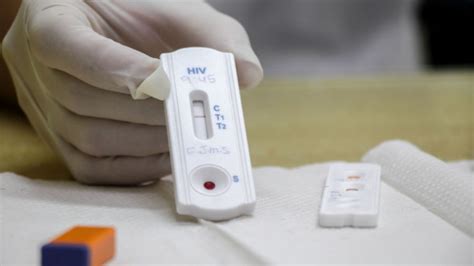 Rede Municipal De Saúde Realiza Teste Rápido Para Hiv Sífilis E