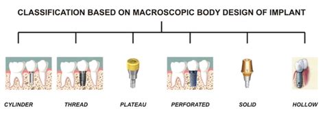 Types of Dental Implants by Sizes, Procedures and Materials