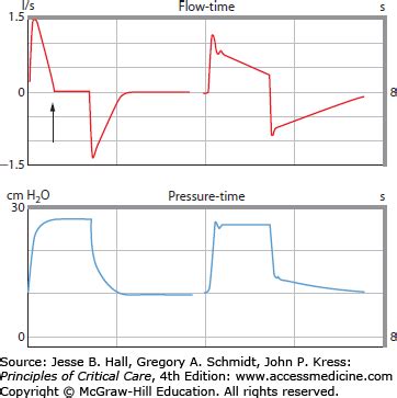 Ventilator Waveforms: Clinical Interpretation | Anesthesia Key