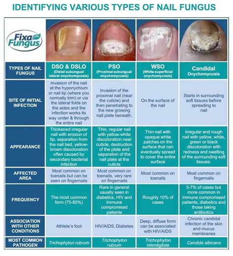 Toe Nail Fungus Types Infographic - Horizon Foot & Ankle Institute