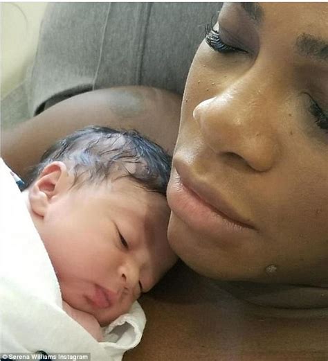 Serena Williams Health Woes Made Me Stronger Daily Mail Online