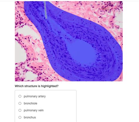 Solved Which Structure Is Highlighted Pulmonary Artery Chegg