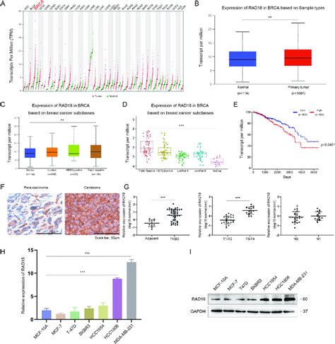 Rad Is High Expression In Tnbc And Positively Correlates With Poor