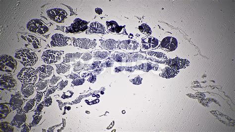 Prophase 1 Of Meiosis Under A Microscope