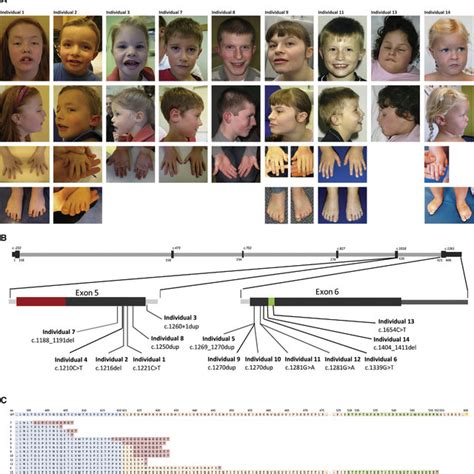 Photographs Of Nine Individuals With A Truncating Mutation In PPM1D De