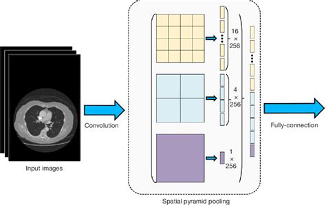 Figure From A Lightweight Neural Network For Lung Nodule Detection