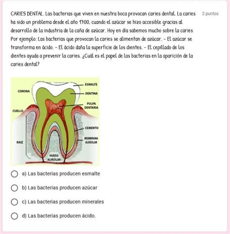 Ayudenme Plisss A Resolver Esto X Favor Con La Respuesta Correcta Es De