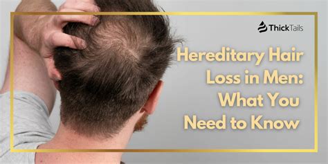 Hereditary Hair Loss