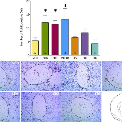 Neonatal Exposure To Phenobarbital Phenytoin Or MK 801 Induces