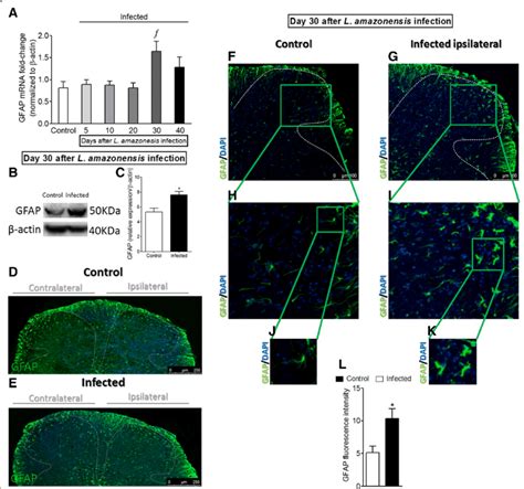 Detection Of Spinal Cord Gfap Induced By I Pl L Amazonensis