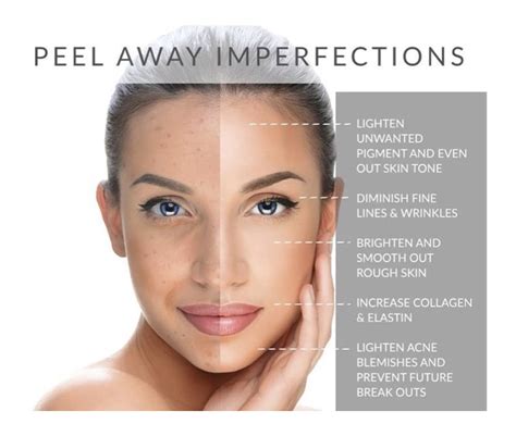 Chemical Peels Skin Glow By Kimberly