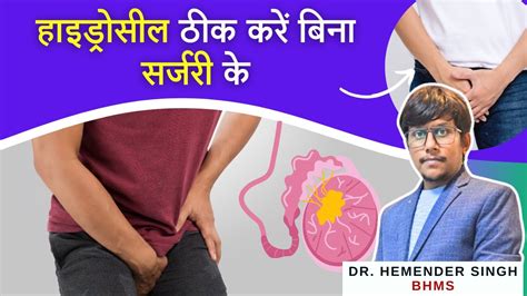 हाइड्रोसील ठीक करें बिना सर्जरी के Treat Hydrocele Naturally With