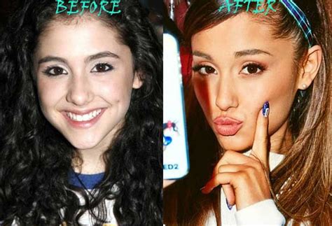 Ariana Grande Plastic Surgery: face modification,lose weight,rhinoplasty