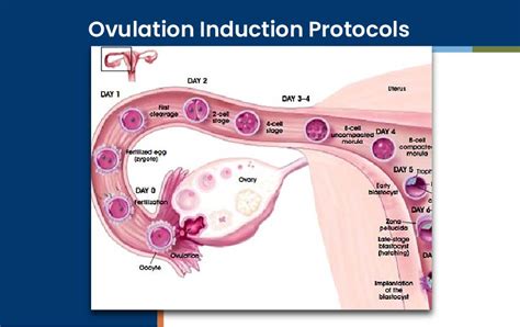 Ovulation Induction Protocols Orkid Medilife Hospital