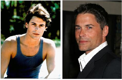 Rob Lowe Plastic Surgery