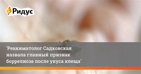 Реаниматолог Садковская назвала главный признак боррелиоза после укуса ...