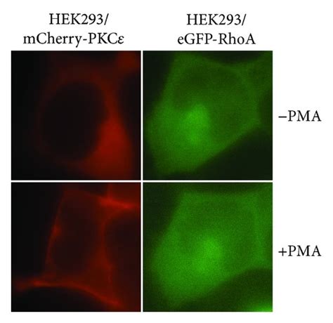 Pkc Colocalizes With Rhoa At The Cell Membrane A Pkc Translocates