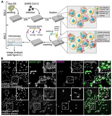 Indirect Immunofluorescence Assay