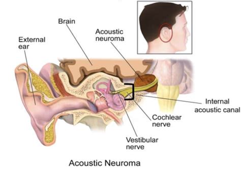 Auditory Nerve And Central Auditory Pathways Flashcards Quizlet