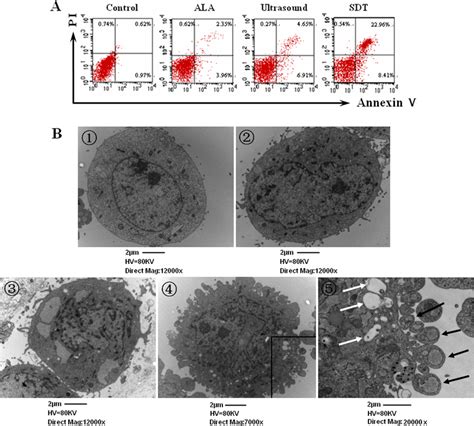 ALA SDT Induces Osteosarcoma Cell Apotosis In Vitro UMR 106 Cells Were