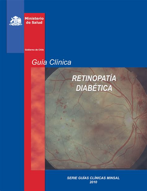 Ir a Guía Clínica Retinopatía Diabética