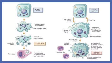 Difference Between Apoptosis Versus Necrosis And Types Of Necrosis Pptx