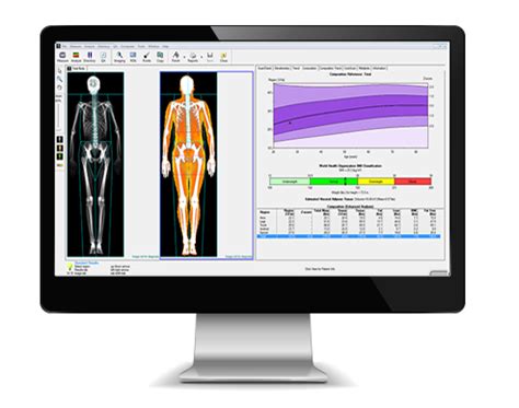 Dexa Scan Near You Most Accurate Body Fat Test Live Lean Rx