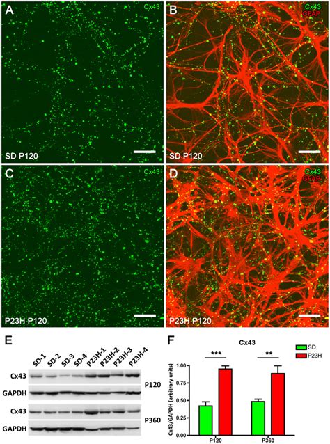 Frontiers Astrocytes And M Ller Cell Alterations During Retinal