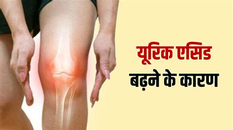 Try These Natural Things To Reduce Uric Acid Level In Your Body Know Causes Symptoms शरीर में