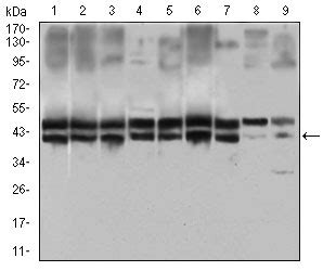 Il Ra Antibody Purified Mouse Monoclonal Antibody Wb Ihc Icc E