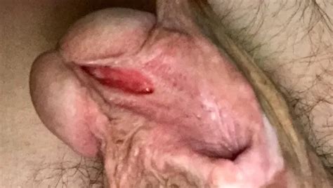 Dicke Zuckende Klitoris Free HD Videos Porn 58 XHamster