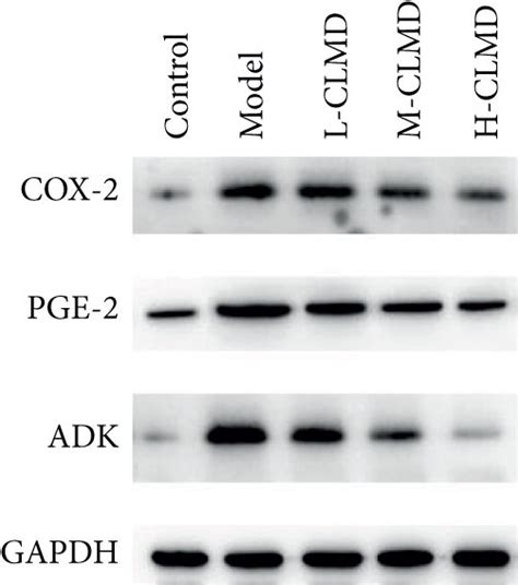 Evaluation Of The Expression Of Proteins Involved In The Cox Pge Adk