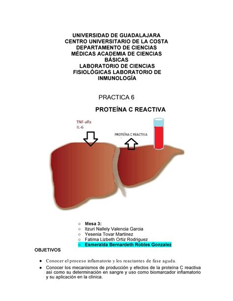 Pr Ctica Prote Na C Reactiva Universidad De Guadalajara Centro