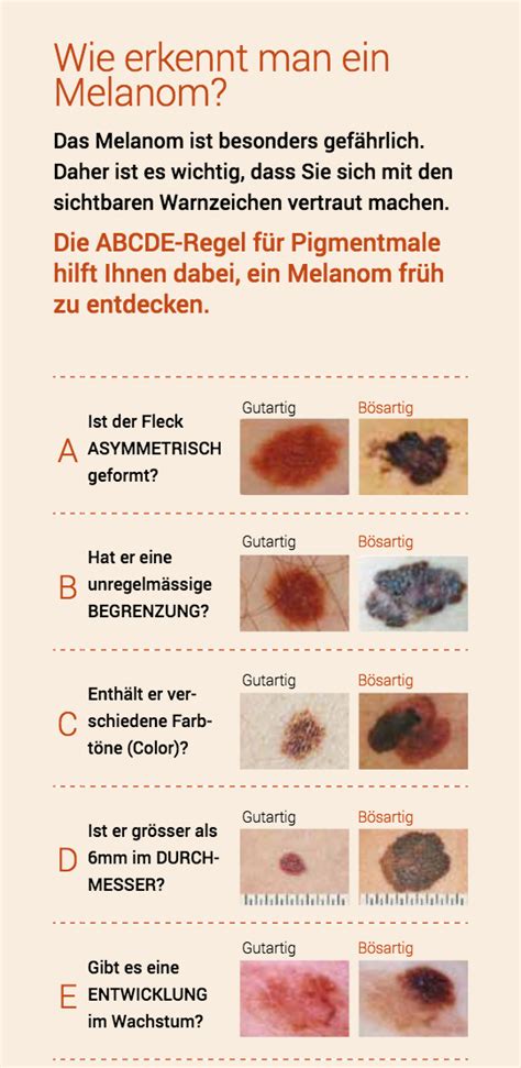 Dermatologische Praxis Dr Gion Tscharner Schwarzer Hautkrebs