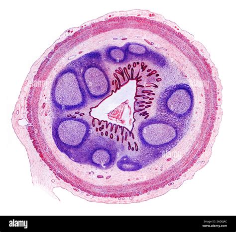 Artwork Of The Histology Of The Human Appendix Showing Arrangement Of