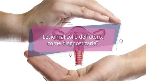 Lesioni Al Collo Dell Utero Come Diagnosticarle News Salute La