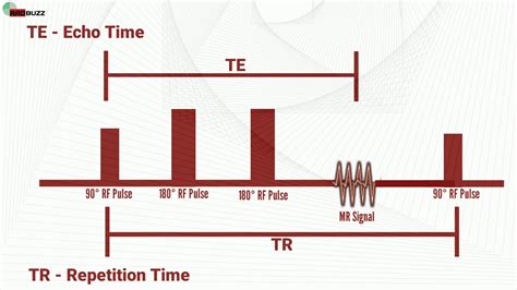 What Is TE And TR In MRI YouTube