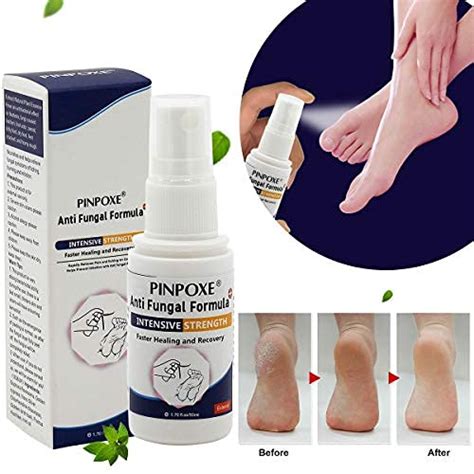 Buy Foot Spray Athletes Foot Spray Athlete Foot Treatment Fungus