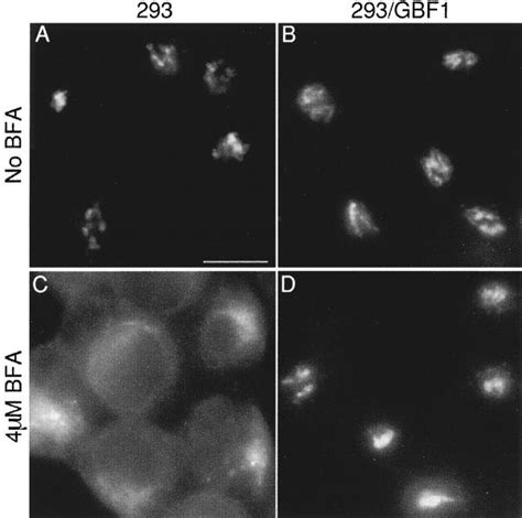 The Golgi Morphology Of 293 Overexpressing Gbf1 Is Resistant To Bfa